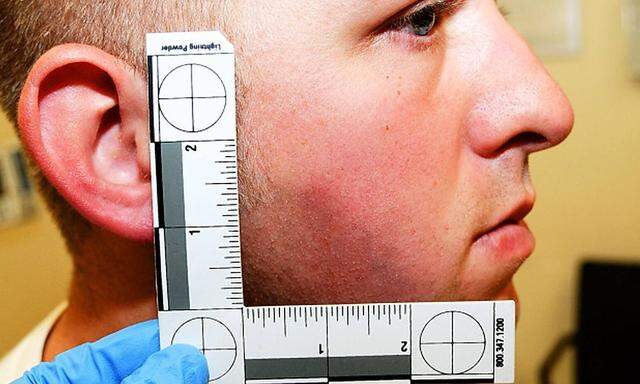 Bei Polizist Darren Wilson wurden Prellungen im Gesicht festgestellt. Er hat in Ferguson einen afroamerikanischen Teenager erschossen.
