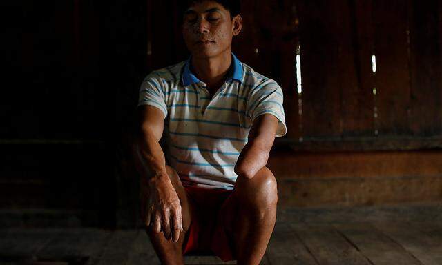 Dieser Laote verlor vor 30 Jahren seinen linken Unterarm durch eine Bombe der USA. Der Vietnamkrieg war damals schon mehr als zehn Jahre vorbei.