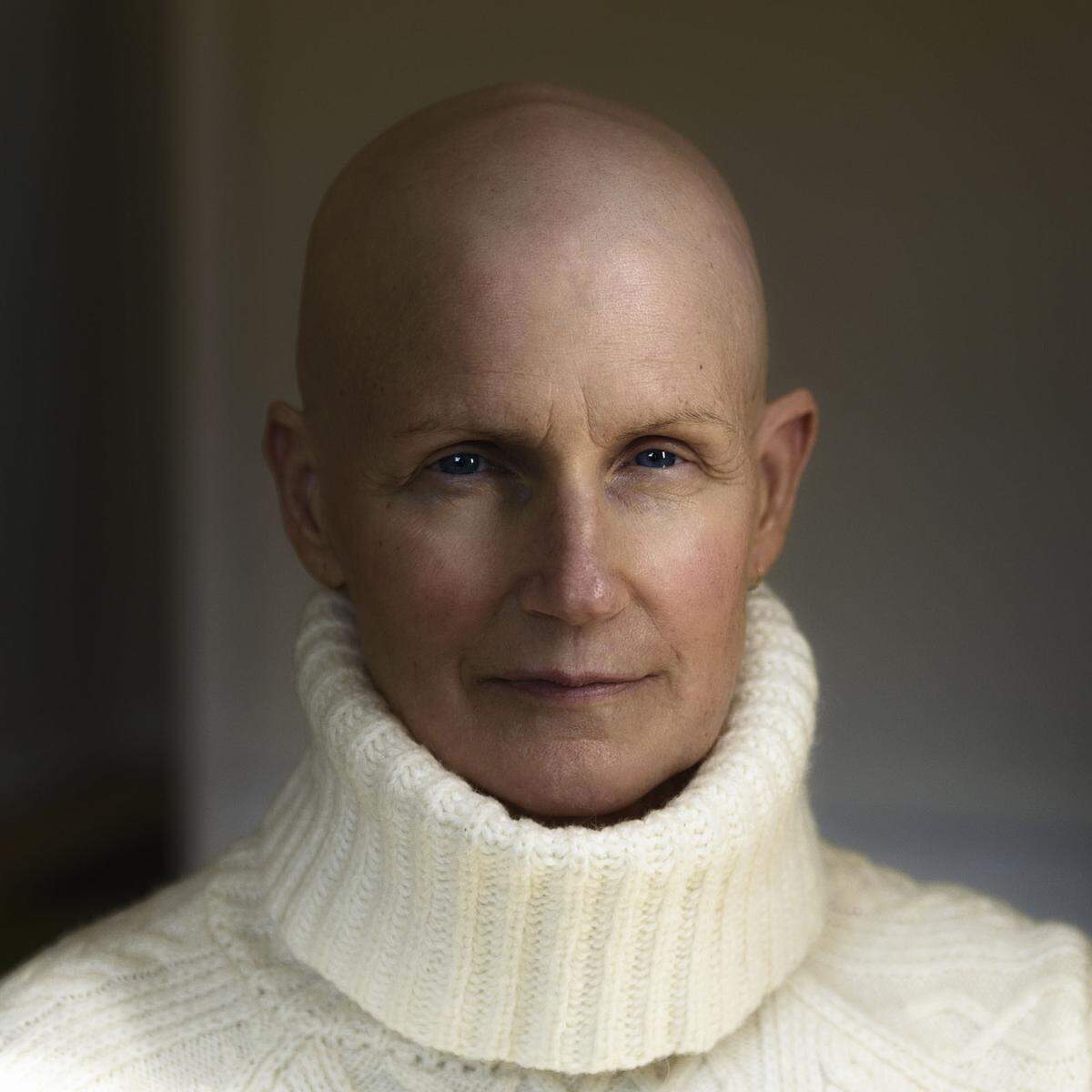 Susan: "Ich habe gerade die Chemotherapie beendet und werde sehen, was passiert. Ich wollte nie eine Perücke tragen, weil das nicht ich bin. Ich möchte mich vor niemandem mehr verstecken."