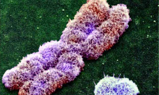 X Chromosom Gene fuer Spermaproduktion
