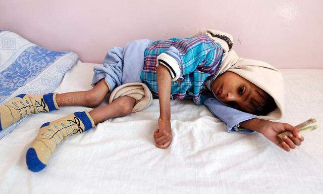 Ein unterernährter jemenitischer Bub.