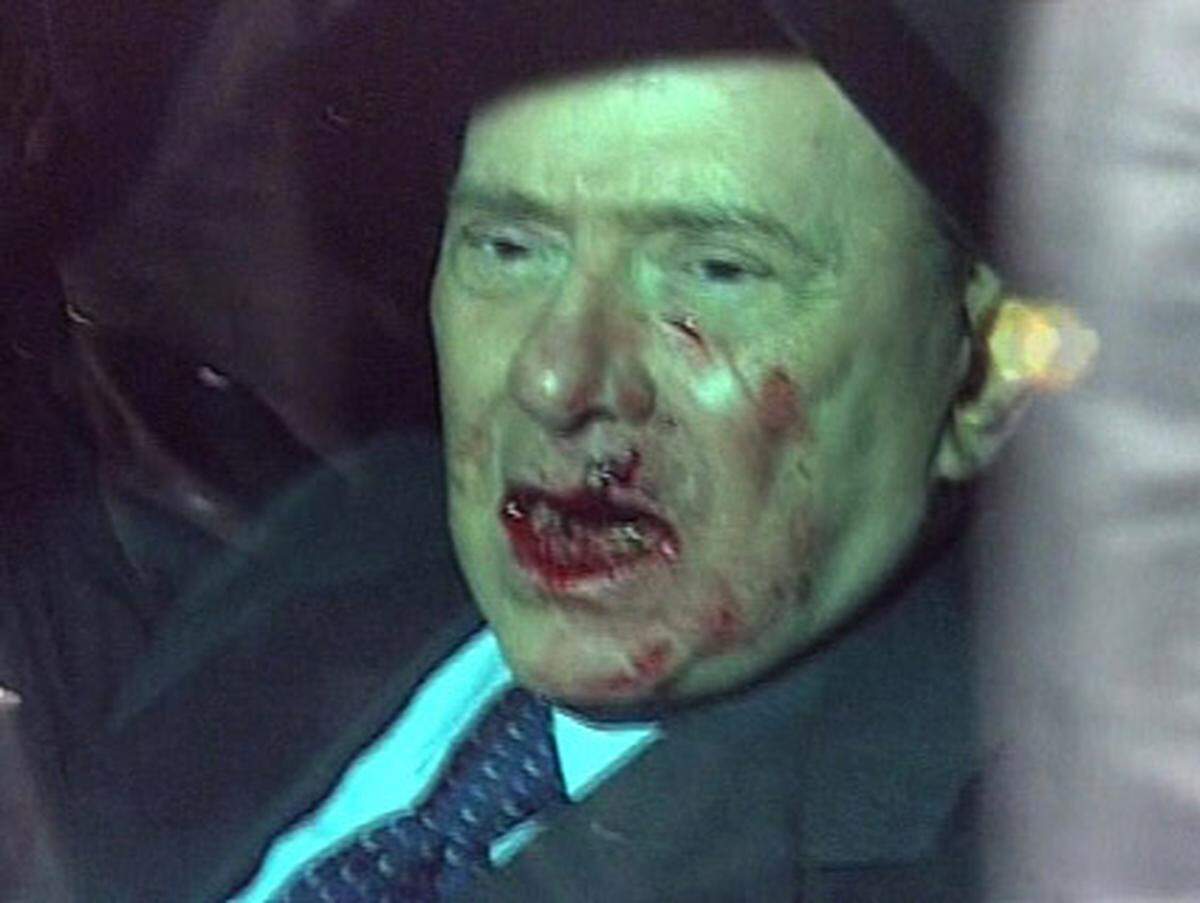 Das Jahr endete für Berlusconi im Spital. Im Dezember schleuderte ein Mann nach einer Parteirede eine Miniatur des Mailänder Doms ins Gesicht des italienischen Regierungschefs. Er erlitt einen Nasenbeinbruch und Verletzungen an der Lippe, außerdem brachen zwei Zähne ab.