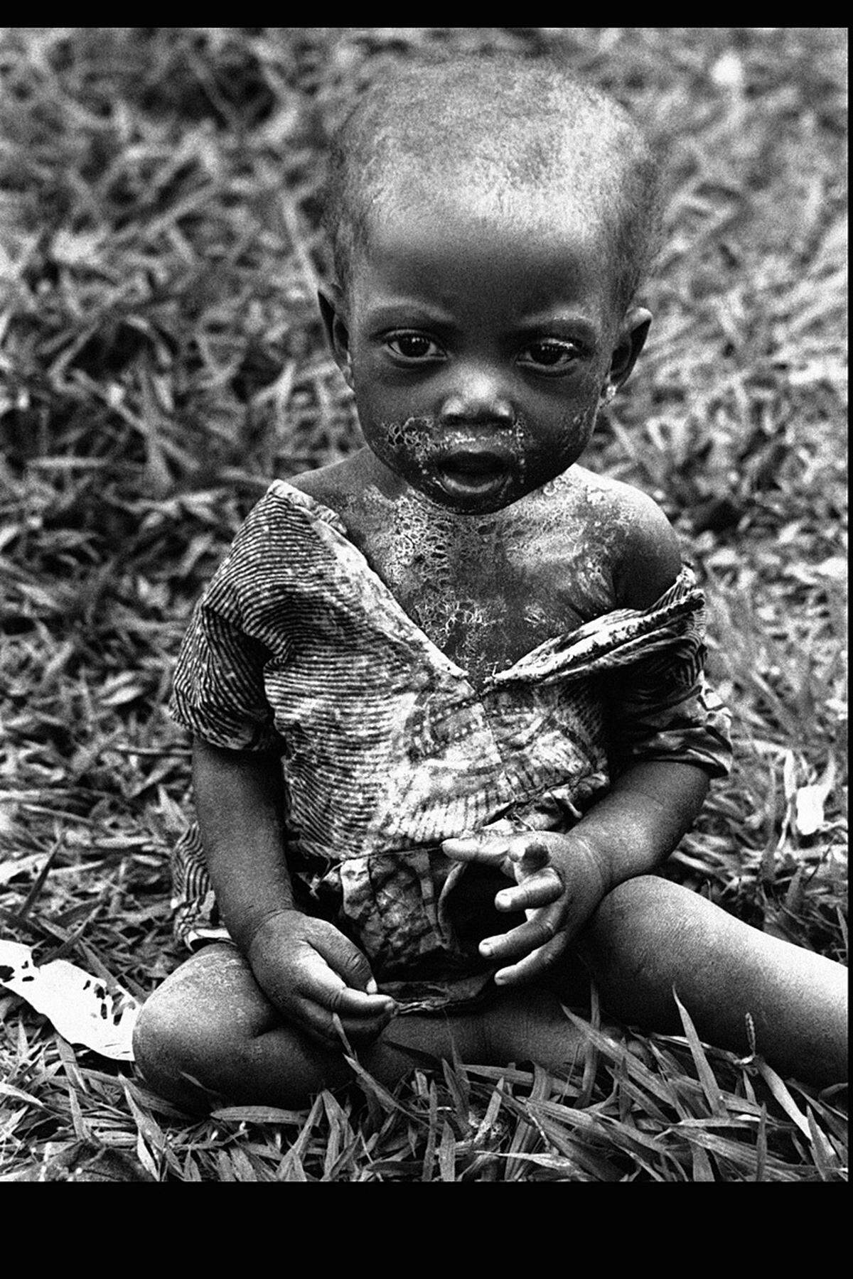 Kongo, 26. Jänner 1961: Ein Kind vor einem Krankenhaus in Miabi, South Kasai.