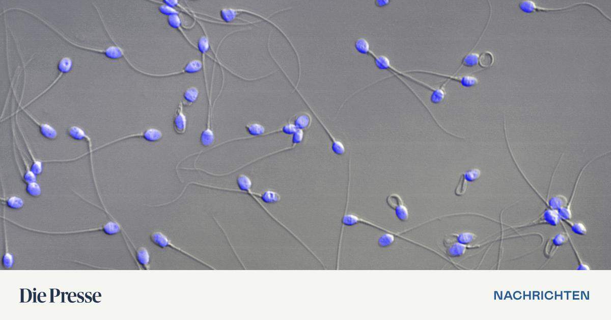 Austrian researchers have discovered a new protein in sperm using computer technology