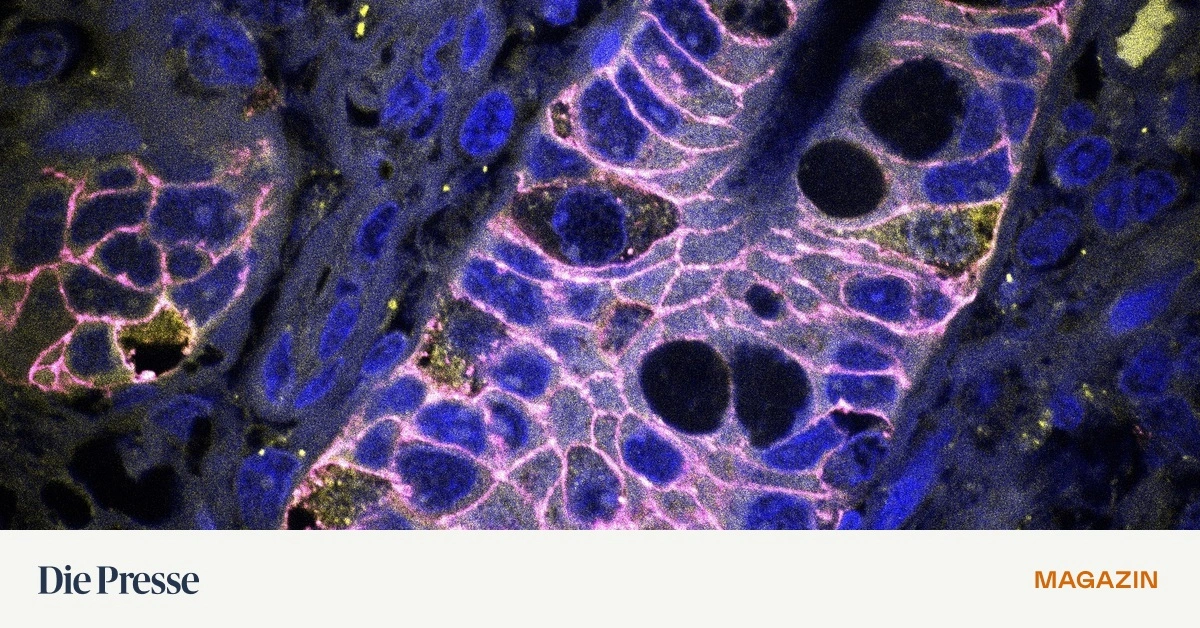 Tiroler-Studien-geben-Hoffnung-bei-Morbus-Crohn-premium-